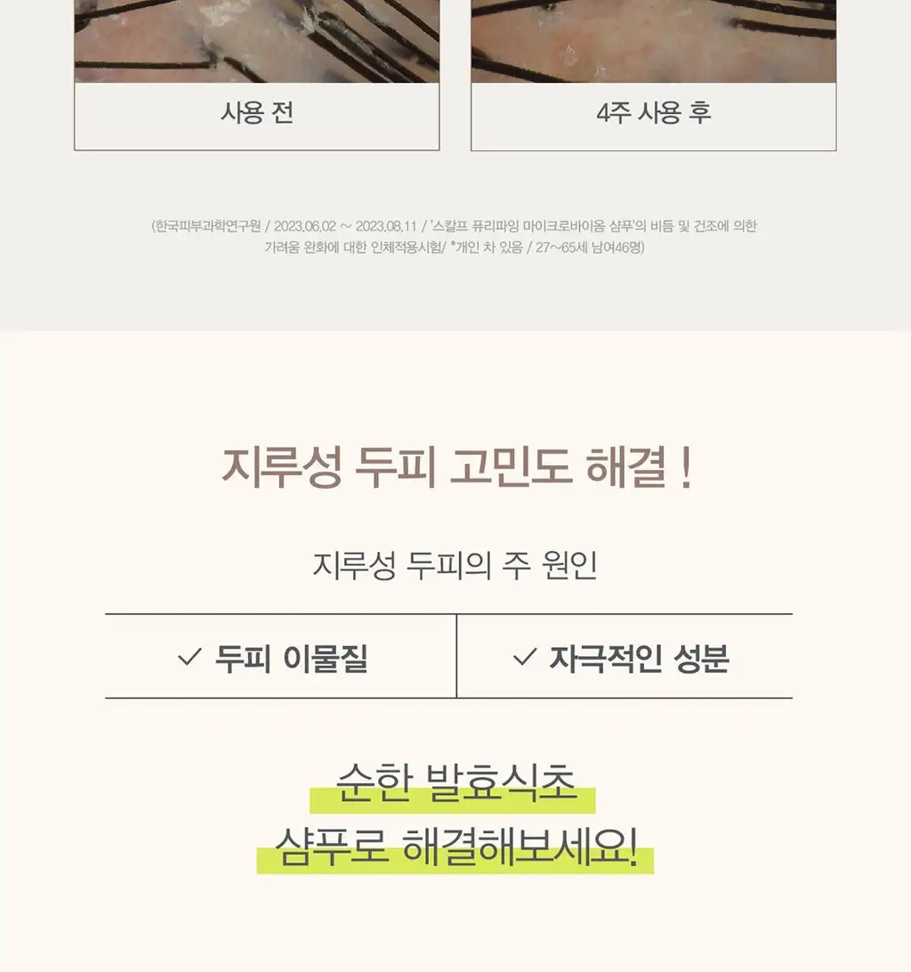 [탈모증상완화/식초샴푸] 원오세븐 스칼프 퓨리파잉 마이크로바이옴 샴푸 380ml 상세페이지 6